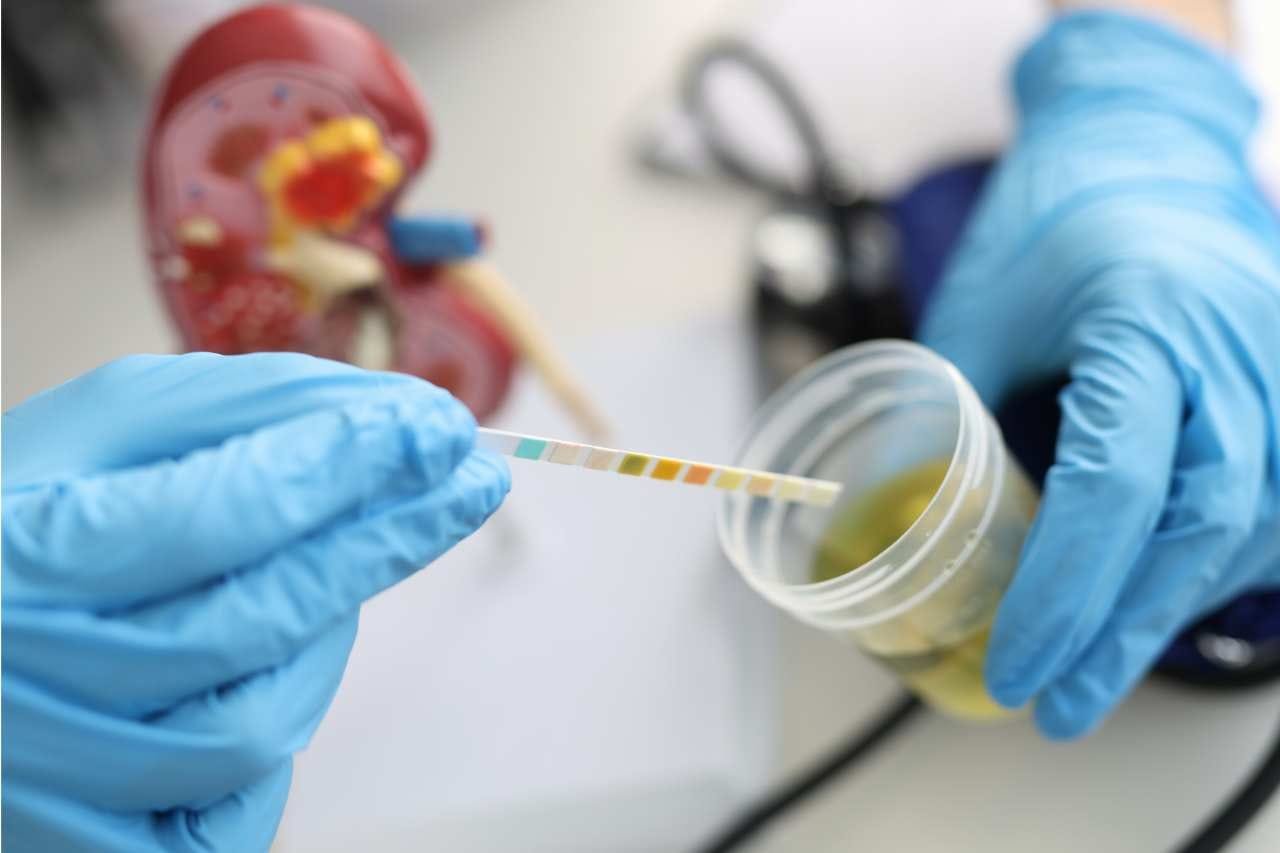 Urine Analysis Services Images